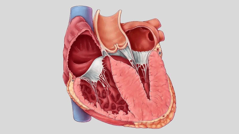 Bệnh Cơ tim phì đại - Tìm hiểu nguyên nhân và cách điều trị hiệu quả