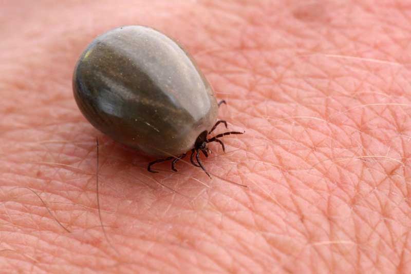 Bệnh Lyme là gì?