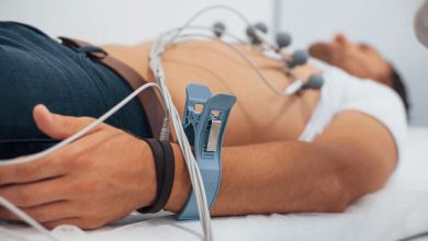 Điện tâm đồ (ECG) là gì?