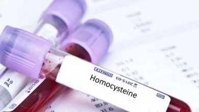 Homocysteine là gì?