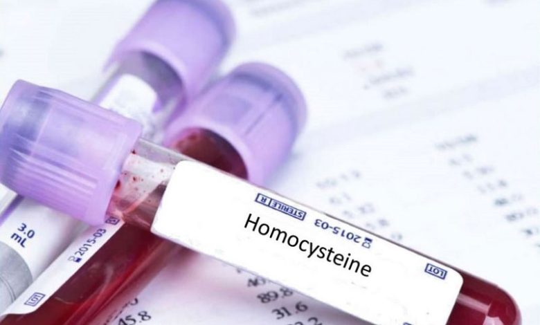 Homocysteine là gì?