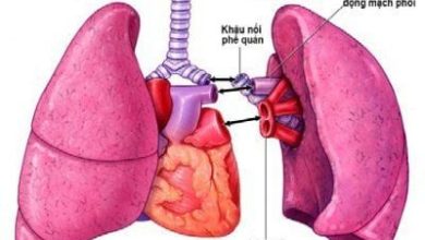 Bệnh phổi kẽ có thể chữa khỏi hoàn toàn không?