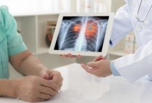 Phát hiện sớm u phổi ác tính không triệu chứng nhờ khám định kỳ