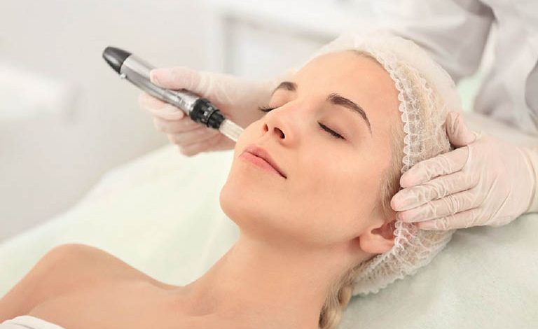 Có nên điều trị nám sau sinh bằng laser hay không?