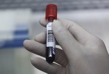Nguy cơ bệnh tật gia tăng do cholesterol máu cao ở người Việt