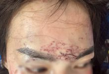 Cà Mau khởi tố vụ nữ giới bị hành hung, xăm mặt dã man