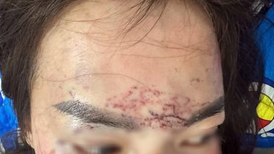 Cà Mau khởi tố vụ nữ giới bị hành hung, xăm mặt dã man