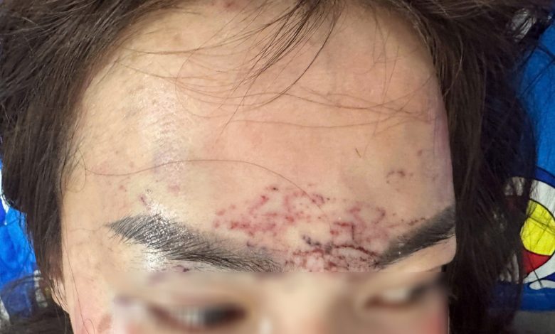 Cà Mau khởi tố vụ nữ giới bị hành hung, xăm mặt dã man
