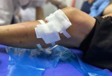 Cụ bà 77 tuổi bị chó becgie tấn công nghiêm trọng