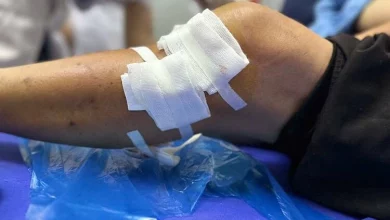Cụ bà 77 tuổi bị chó becgie tấn công nghiêm trọng