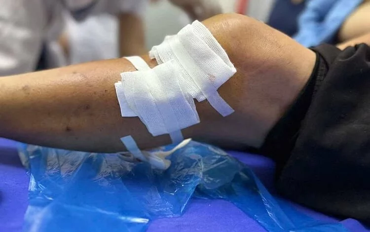 Cụ bà 77 tuổi bị chó becgie tấn công nghiêm trọng