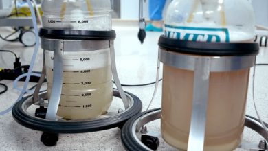 Rửa phổi thành công cho bệnh nhân mắc bệnh tích protein phế nang