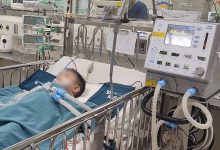 Bé trai 4 tuổi hồi phục sau chấn thương, phản ánh vụ cấp cứu