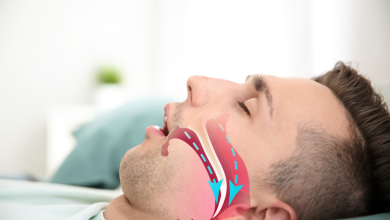 Đột quỵ do ngưng thở khi ngủ: Nguy hiểm và giải pháp điều trị