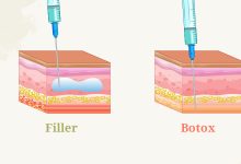 Tiêm filler và botox khác nhau như thế nào?