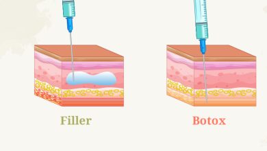 Tiêm filler và botox khác nhau như thế nào?