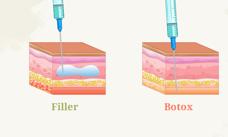 Tiêm filler và botox khác nhau như thế nào?